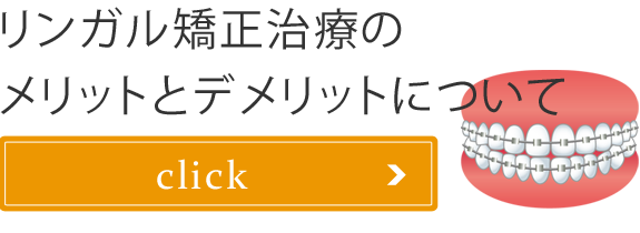 リンガル矯正治療のメリットとデメリットについて