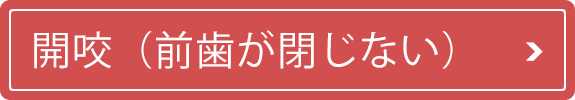 開咬（前歯が閉じない）